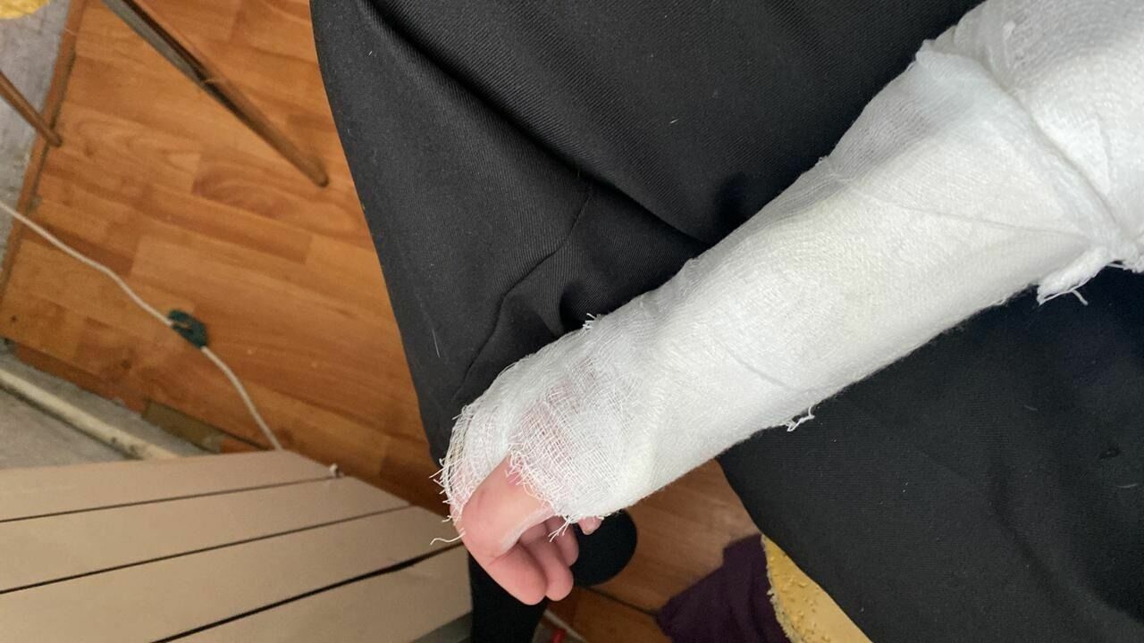 Жительница Нижнего Тагила сломала руку из-за наледи возле дома на улице Ильича